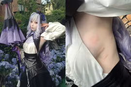 Hết mình vì đam mê, nữ coser lộ ảnh "làm mồi" cho muỗi