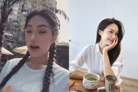 Doãn Hải My liên tiếp dính nghi vấn "dao kéo"