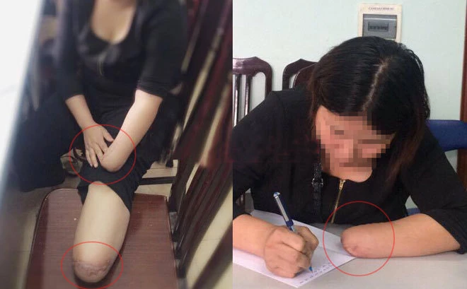 Muôn chiêu trò lừa đảo trục lợi tiền bảo hiểm 