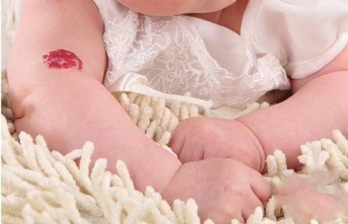 Người có vết bớt trên cánh tay: Người có vết bớt trên cánh tay, kiếp trước họ là dũng sĩ trong thiên hạ, kiếp trước nhất định là anh hùng, nếu không nhập thế thì sẽ thành La Hán!