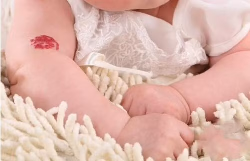 Người có vết bớt trên cánh tay: Người có vết bớt trên cánh tay, kiếp trước họ là dũng sĩ trong thiên hạ, kiếp trước nhất định là anh hùng, nếu không nhập thế thì sẽ thành La Hán!