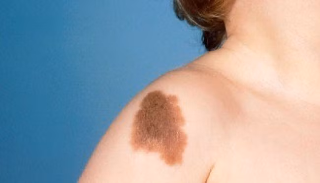 Nhờ vận may của mình mà 5 năm qua người nhà tránh xa tai họa, mọi việc thuận buồm xuôi gió, được quý nhân xung quanh giúp đỡ, tiền bạc sung sướng, cuộc sống như ý, gia đình hưng vượng và thịnh vượng trong một trăm năm!