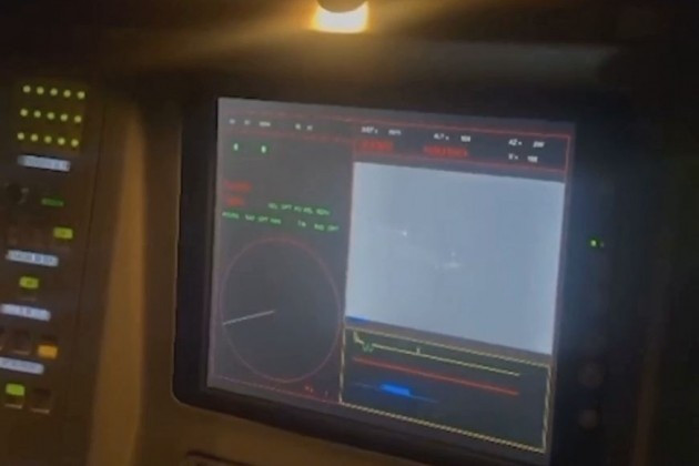 ウクライナが現在も使用しているソ連時代のS-300防空システムは、射程距離は長いものの、旧式のレーダーシステムを搭載しているため、現代の無人航空機(UAV)に対して苦戦を強いられています。クロタレはコンパクトな設計と、行軍から戦闘開始までわずか5分という迅速な移行時間により、機動部隊や市街地の防衛に理想的な防空兵器となっています。これは、大型システムには到底及ばない柔軟性です。 7.jpg