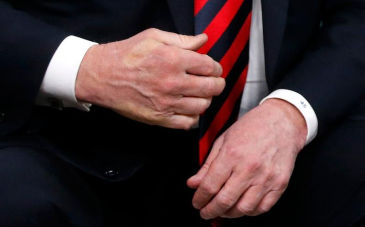 Dấu ấn ngón tay cái của Tổng thống Macron hằn trên tay của Tổng thống Trump sau cái bắt tay tại cuộc gặp song phương.