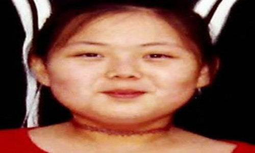 Kim Yo Jong từng có thời gian theo học tại Thụy Sĩ, cũng tại ngôi trường mà người anh trai Kim Jong-un của bà đã theo học. Tuy nhiên, bà trở về Triều Tiên vào năm 2000 sau khi học xong lớp 6.