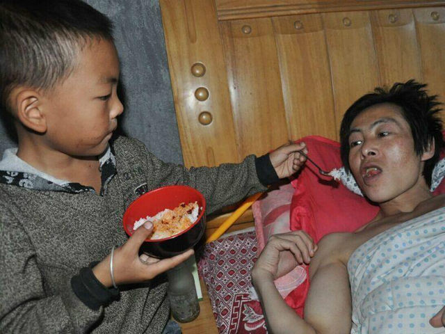 "Cháu không thể sống thiếu bố được", Yanglin chia sẻ. Mong muốn của bé là sẽ kiếm được tiền chữa bệnh cho cha.