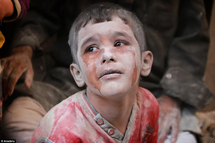 Một bé trai Syria bị thương giữa cảnh tượng đổ nát ở khu Firdevs, Aleppo, ngày 11/10/2016.