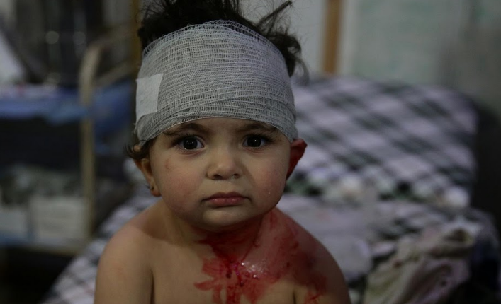 Một em nhỏ bị thương đang được điều trị tại một bệnh viện dã chiến ở Douma. Các vụ nã pháo nhằm vào Douma trong ba năm qua đã phá hoại dịch vụ y tế ở thành phố này.