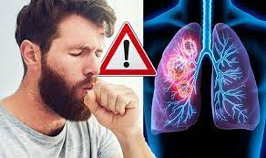 Nhiều người có thể nghĩ rằng, ho dai dẳng chỉ là do bị cảm lạnh hoặc triệu chứng của COVID-19 nhưng các bác sĩ cảnh báo, bạn không được chủ quan, bỏ qua dấu hiệu này. Ảnh: Express.