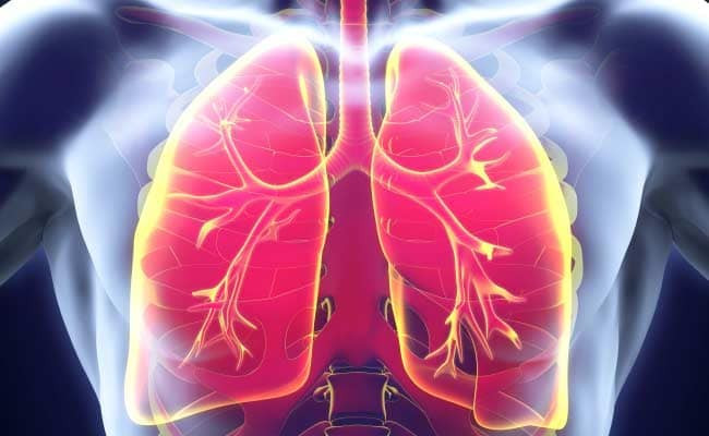 Tiến sĩ Tim Woodman cho biết, bất cứ ai cũng có thể bị ung thư phổi, chứ không chỉ những người hút thuốc. Ảnh: NDTV.