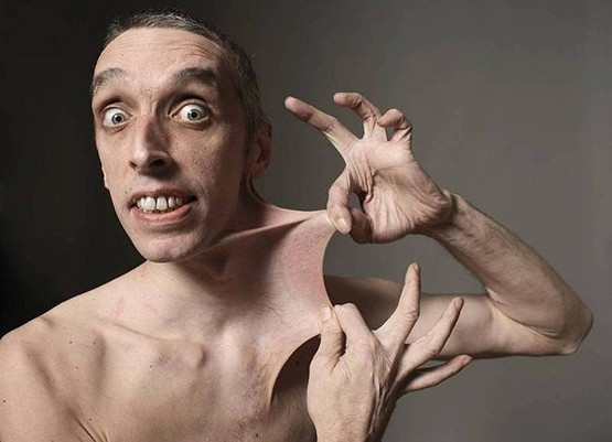 Garry Turner (Anh) đã được kỉ lục Guinness thế giới công nhận là người có làn da co giãn nhất thế giới. Anh có thể căng da bụng giãn ra 15,8 cm.