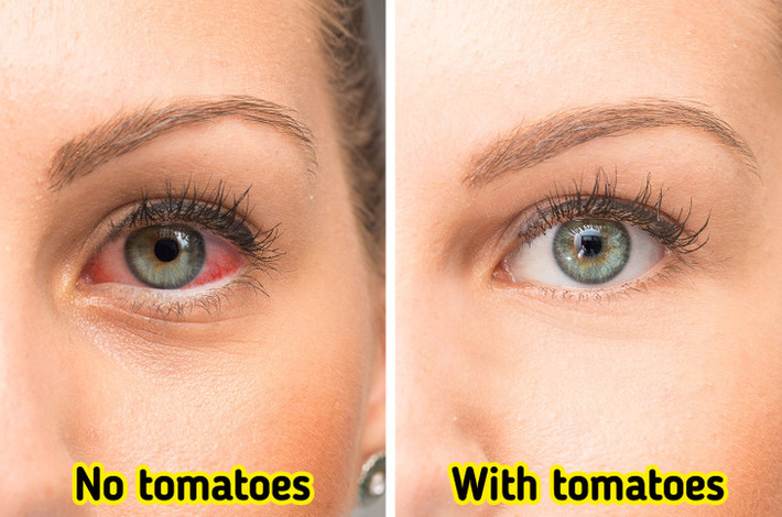 3. Cà chua có thể cải thiện thị lực của bạn: Ngoài lycopene, cà chua chứa nhiều chất dinh dưỡng khác như lutein và beta-carotene, rất tốt cho mắt. Nghiên cứu cho thấy những chất dinh dưỡng này giúp ngăn mắc các bệnh về mắt như đục thủy tinh thể. Ảnh: BS.