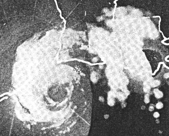 Bão Audrey năm 1957 được cho là đã khiến hơn 400 người thiệt mạng tại Louisiana. Đây là cơn bão chết chóc thứ 6 trong lịch sử nước Mỹ.