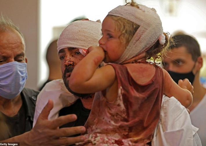 Theo New York Times, hai vụ nổ lớn vừa qua đã khiến nhiều bệnh viên ở thủ đô Beirut bị hư hại hoặc rơi vào tình trạng quá tải. Ảnh: Getty.