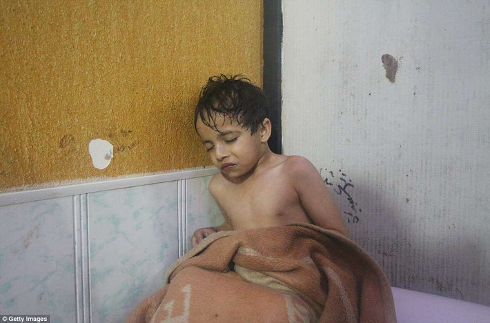 Một em nhỏ bị khó thở đang chờ được điều trị tại bệnh viện. Ảnh: Getty.