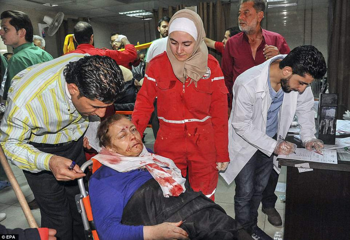 Một phụ nữ Syria bị thương đang được điều trị tại bệnh viện Al Mouwasat, Damascus. Ảnh: EPA.