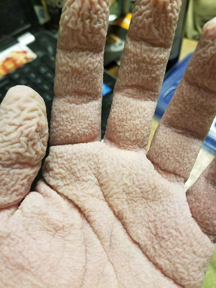 Ngủ gật trong bồn tắm và hậu quả...