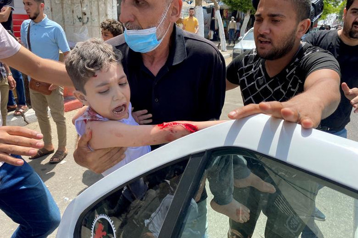 Một em nhỏ Palestine được đưa tới bệnh viện sau khi bị thương tại thành phố Gaza giữa lúc căng thẳng Israel-Palestine leo thang.