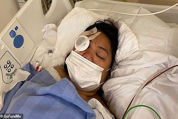 Chú của Dimalanta, Dexter Martin, cho hay một viên đạn đã "xuyên thẳng vào mắt phải của Dimalanta", khiến cô gái bị thương tật vĩnh viễn. Ảnh: GoFundMe.