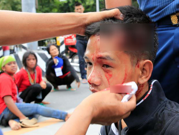 Một người tham gia cuộc biểu tình ở Philippines bị thương hôm 19/10. Ảnh: Reuters.