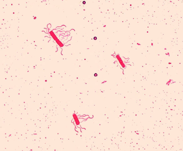 Thông tin trên Vietnamnet cho biết, Bacillus cereus là loại vi khuẩn phổ biến, dễ dàng có mặt trong nhiều loại thực phẩm, món ăn. Khi gặp điều kiện không thuận lợi: khô, nóng do quá trình xử lý, chế biến, bảo quản thực phẩm, B.cereus vẫn có thể tồn tại ở dạng bào tử. Bào tử vi khuẩn chỉ bị giết khi hấp ướt 121 độ C trong 20 phút hoặc sấy khô 160 độ C trong 1 giờ. Món ăn sau khi nấu nướng, nếu được để nguội vài giờ trước khi ăn, bào tử vi khuẩn có thể trở lại trạng thái sinh trưởng và nhân lên. Ảnh: Wikipedia.