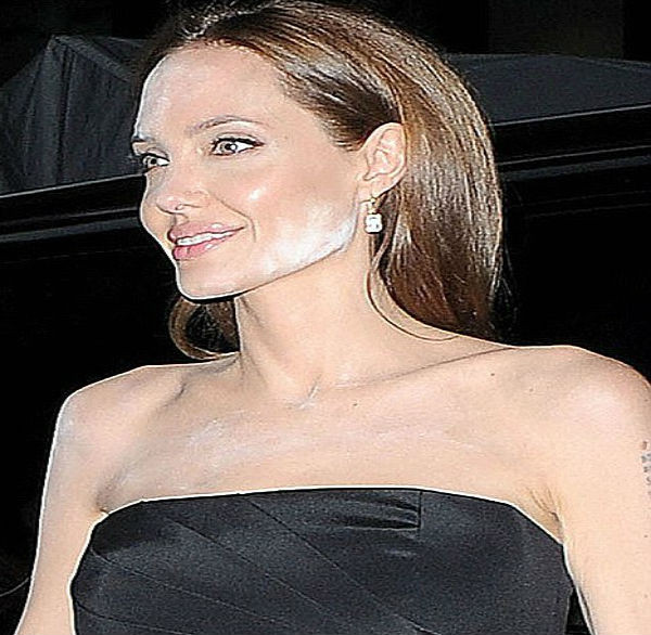 Không chỉ bà Bành Lệ Viện, nhiều người nổi tiếng như nữ diễn viên Angelina Jolie...