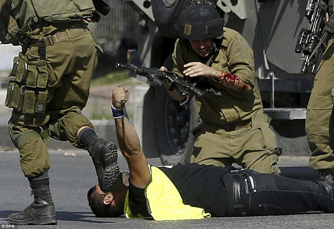 Cánh tay binh sĩ Israel chảy máu sau khi bị đâm.