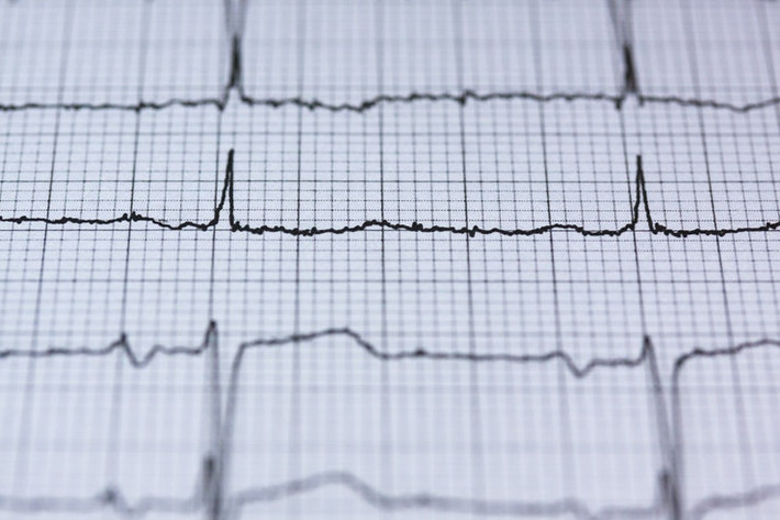 Giảm nguy cơ mắc bệnh tim: Lượng HDL cholesterol cao sẽ giúp cơ thể loại bỏ LDL (cholesterol “xấu”). Nghiên cứu nhiều năm chỉ ra rằng, lượng LDL cholesterol cao có liên quan đến việc tăng nguy cơ mắc bệnh tim.