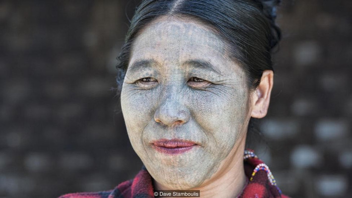 Chị Pam Hung, 28 tuổi, là một trong rất ít người Chin thế hệ trẻ thực hiện việc xăm mặt. Chị mồ côi từ nhỏ và những người cao niên trong làng nói rằng chị nên xăm để được thần linh bảo vệ. Dù chính phủ đã cấm tập tục, bang Chin vẫn là vùng hẻo lánh, lạc hậu và nhiều người dân ở đây rất hiếm khi giao lưu với bên ngoài.