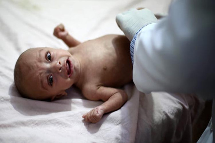 Một em nhỏ đang được kiểm tra trong bệnh viện ở Ghouta. Ảnh: Getty Images.