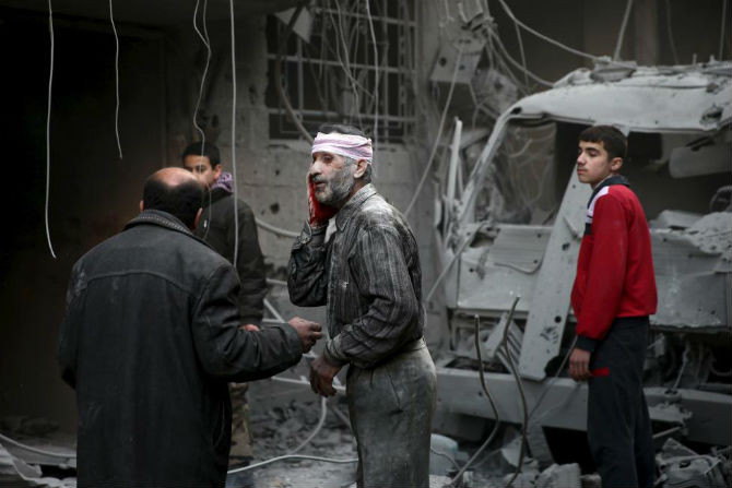 Một người đàn ông bị thương tại thị trấn Douma, Ghouta.