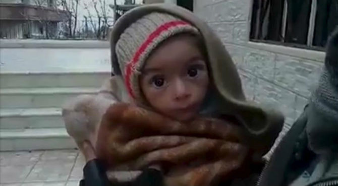 Giao tranh ác liệt kéo dài khiến hàng triệu người rơi vào cuộc khủng hoảng nhân đạo ở Syria. Bức ảnh về một em bé suy dinh dưỡng trầm trọng này được chụp ở Madaya ngày 5/1/2016.