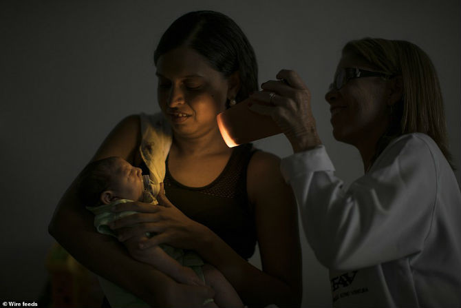 Bé Juan Pedro là một trong 3.400 trường hợp nghi bị tật đầu nhỏ có thể liên quan đến virus Zika.