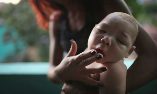 Theo Tổ chức Y tế Thế giới (WHO), sự bùng phát dịch bệnh do virus Zika có thể lan rộng sang tất cả các quốc gia Châu Mỹ, trừ Canada và Chile.