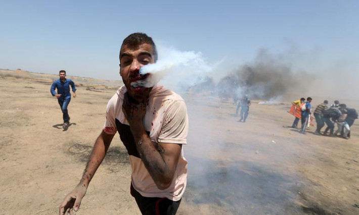 Một người biểu tình Palestine bị thương trong cuộc đụng độ với binh sĩ Israel tại khu vực biên giới Israel-Gaza ở phía nam Dải Gaza.