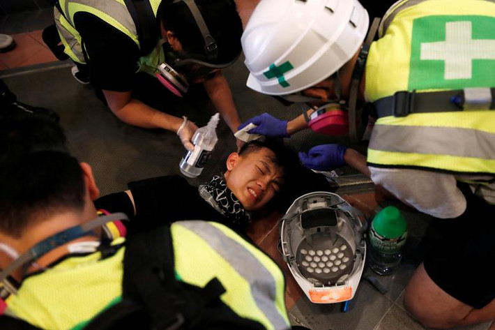 Một thanh niên bị trúng hơi cay trong cuộc đụng độ với cảnh sát ở Đại học Bách khoa Hong Kong hôm 11/11.
