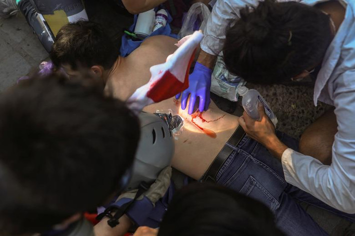 Một người biểu tình bị thương trong vụ đụng độ với cảnh sát Chile được chăm sóc y tế.