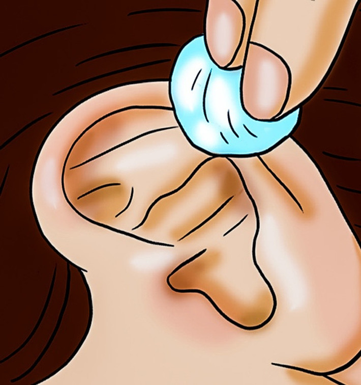 5. Bôi nước gừng để giảm đau nhức tai: Thoa nước gừng quanh phần ngoài của tai, gừng có đặc tính chống viêm có thể giúp giảm đau tai.