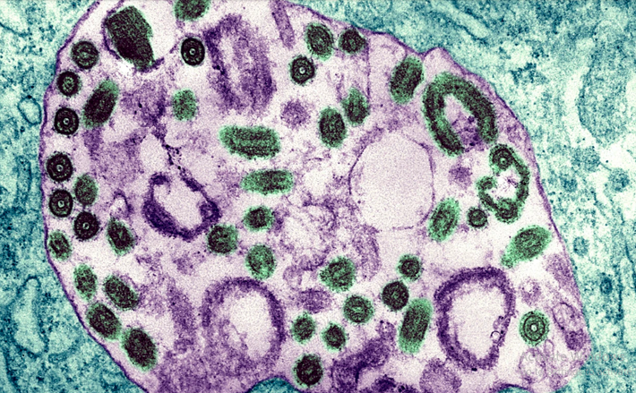 Marburg là bệnh sốt xuất huyết do virus cùng họ với Ebola gây ra và có khả năng lây nhiễm cao, tỷ lệ tử vong cao. Theo Tổ chức Y tế Thế giới (WHO), tỷ lệ tử vong trong đợt bùng phát đầu tiên (năm 1967) là 24%, nhưng tỷ lệ này là 83% trong đợt bùng phát năm 1998-2000 ở Cộng hòa Dân chủ Congo và 100% trong đợt bùng phát năm 2017 ở Uganda. Ảnh: Getty.