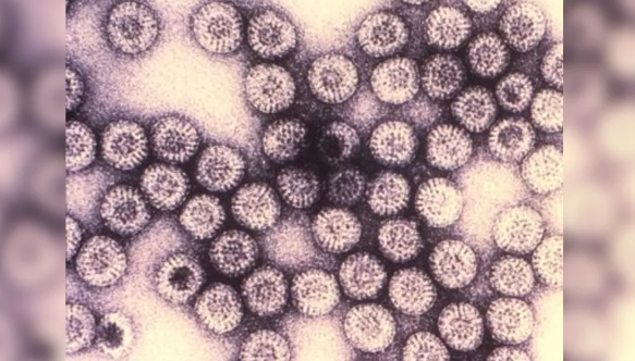 9. Virus Rota: Virus rota gây bệnh tiêu chảy khiến khoảng 200.000 trẻ tử vong mỗi năm, chủ yếu là ở Nigeria và Ấn Độ, theo PreventRotavirus. Ảnh: CDC.