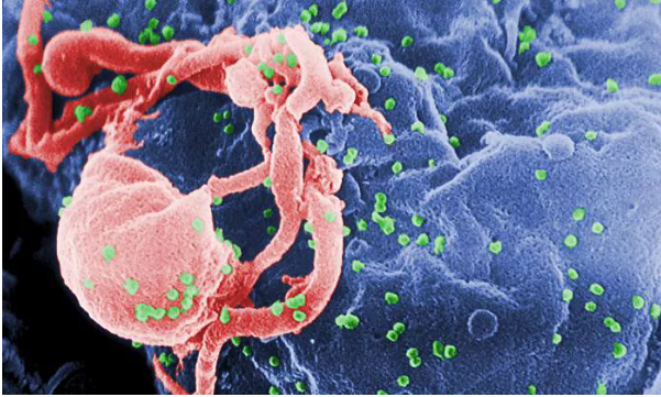 4. Virus HIV: Ước tính có khoảng 32 triệu người đã chết vì HIV kể từ khi căn bệnh này được phát hiện lần đầu tiên vào đầu những năm 1980. Vào năm 2021, có 650.000 ca tử vong liên quan đến HIV trên toàn thế giới. Ảnh: CDC.