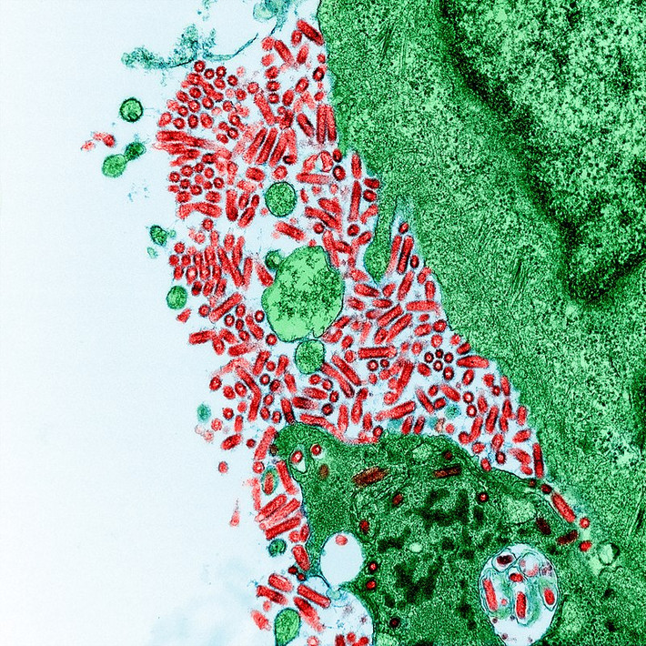 Sau khi bị động vật nhiễm virus rabies cắn hoặc cào, bạn phải đi tiêm vắc xin phòng dại hoặc điều trị ngay lập tức. Nếu không, virus sẽ làm tổn thương não và dây thần kinh. Theo CDC, virus này có tỷ lệ tử vong là 99%. Ảnh: Wikipedia.