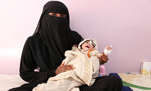 Nhiều đứa trẻ Yemen đang chết dần vì nạn đói và tình trạng suy dinh dưỡng cấp tính. Ảnh: AJ.