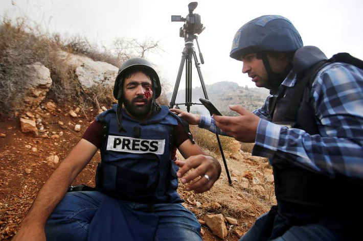 Phóng viên Muath Amarna người Palestine bị bắn vào mắt khi đưa tin về cuộc biểu tình phản đối khu định cư Do Thái gần Hebron, Bờ Tây, ngày 15/11/2019.