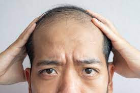 Ngược lại, lông mày thưa thớt, tốc độ sinh trưởng chậm phản ánh các mô và cơ quan tiếp nhận máu chậm, nội tiết tố tiết ra tương đối yếu.
