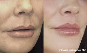 Từ khuôn mặt trên cơ thể con người cũng có thể dự đoán tuổi thọ của người đó. Nếu nhân trung của một người sâu, rõ ràng và dài, có nghĩa là sức khỏe của người đó dồi dào, thể chất cường tráng và tuổi thọ thường sẽ cao hơn.