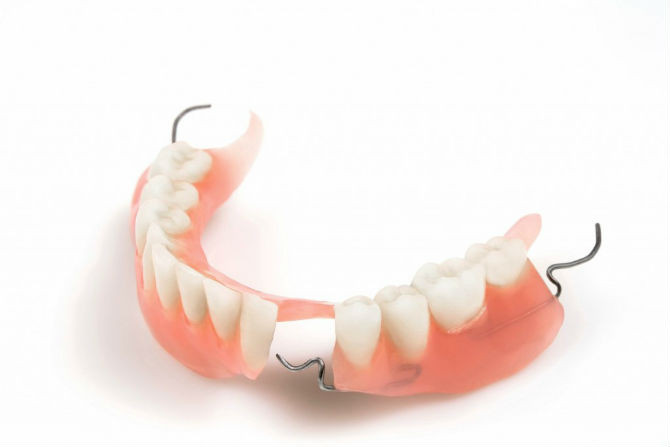 Một sự thật chắc hẳn ít người biết: Trước những năm 1800, răng giả đã được làm từ răng của các binh lính chết trên chiến trường.