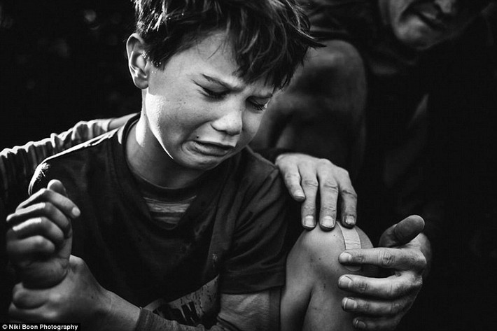Khuôn mặt méo mó của bé trai khi bị thương.