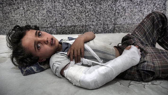 Sau hơn hai năm chìm trong nội chiến, Yemen đối mặt với một trong những cuộc khủng hoảng nhân đạo tồi tệ nhất trên thế giới. Dịch tả bùng phát và nạn đói hoành hành đã đe dọa mạng sống của người dân ở quốc gia Trung Đông bị chiến tranh tàn phá nặng nề này.
