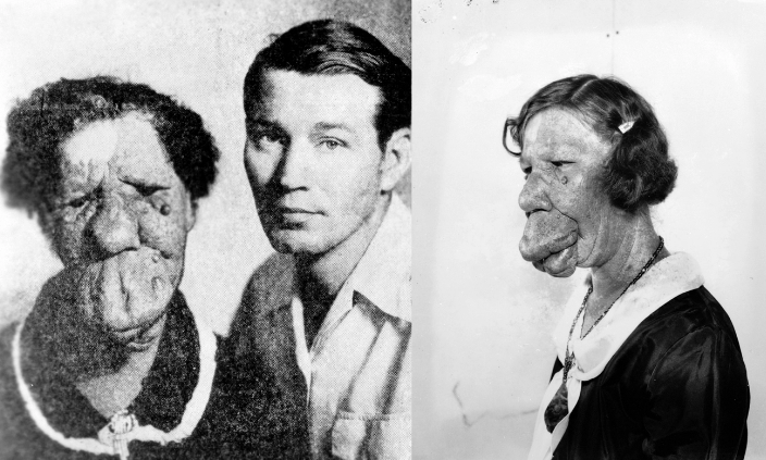 Grace McDaniels là người phụ nữ xấu nhất thế giới. Bà sinh tại Iowa (Mỹ) năm 1888 và từng kết hôn ba lần. Ảnh: PL.